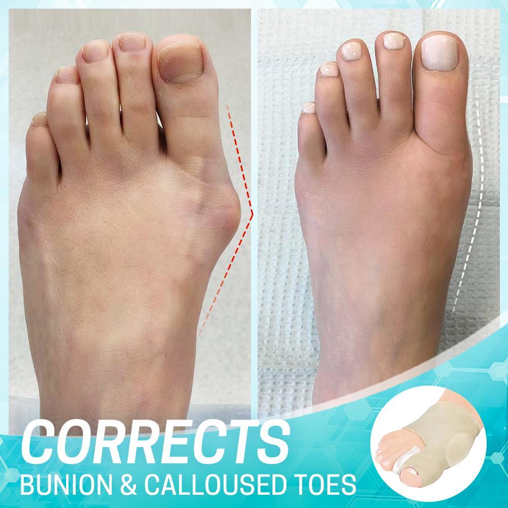 Dr.Fit Bunion Corrector Sleeve