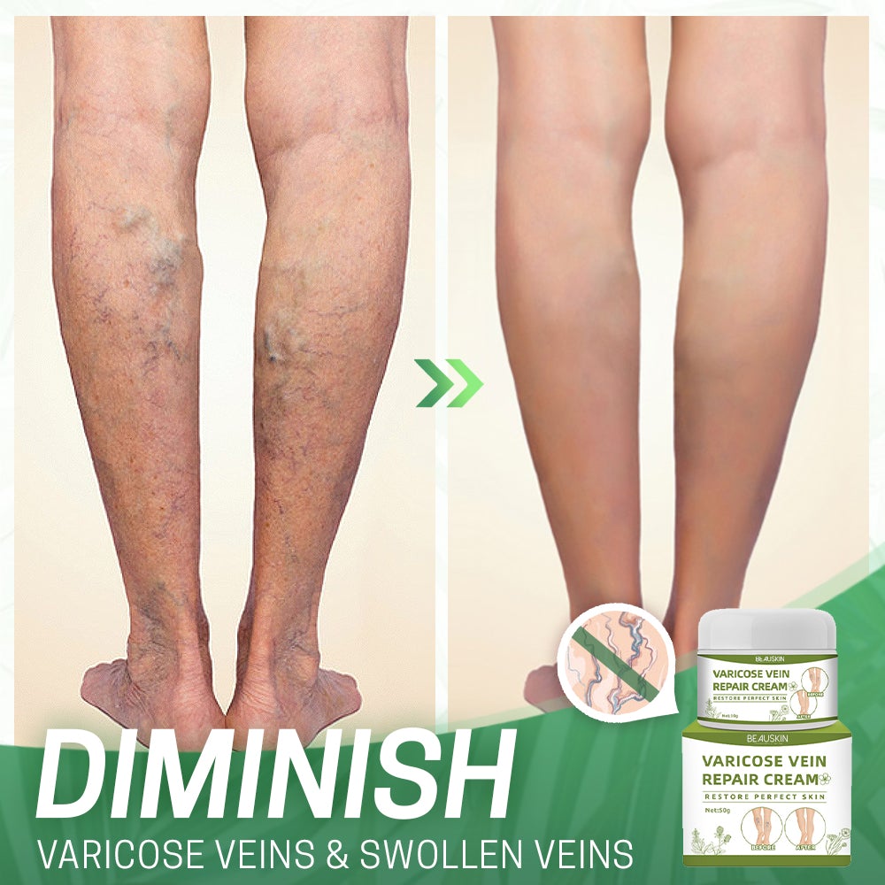 BeauSkin™ Spider Veins Repair Cream