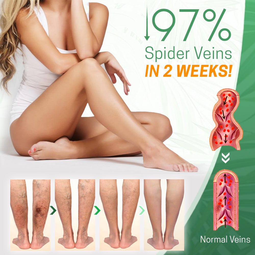 BeauSkin™ Spider Veins Repair Cream