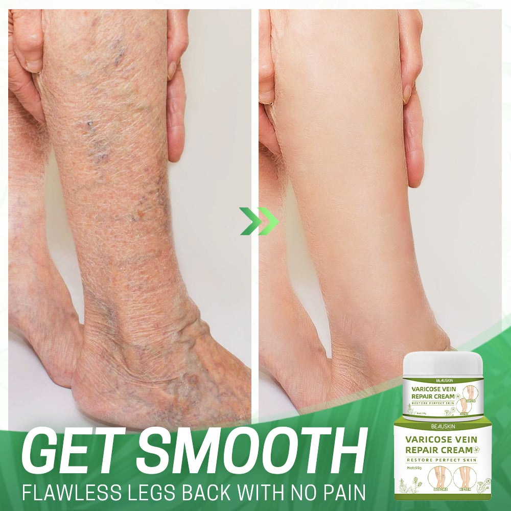 BeauSkin™ Spider Veins Repair Cream